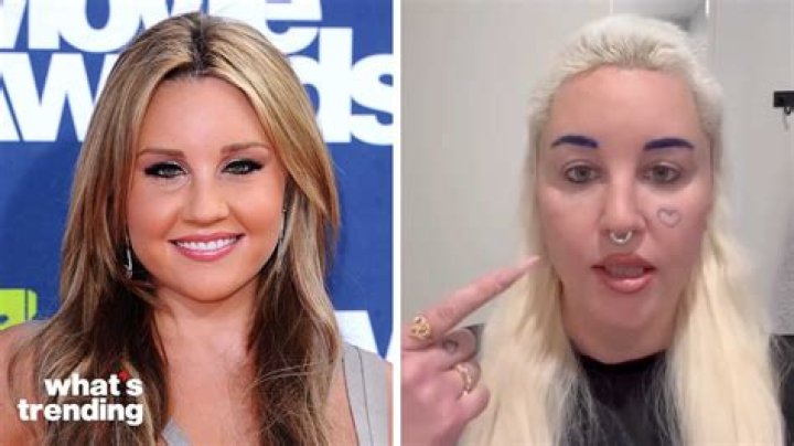 Amanda Bynes Got the Eyelid Surgery That Vogue Says Is on the Rise
