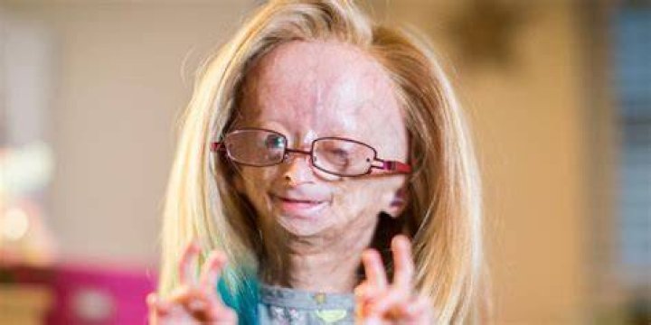 Did Adalia Rose die? Wiki Age, Parents, Net Worth, Funeral, Family, Story