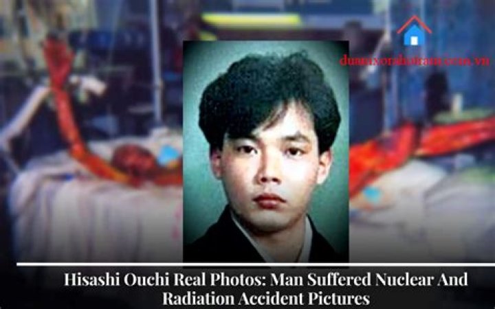 Hisashi Ouchi Real Photos &raquo; Technicalmirchi