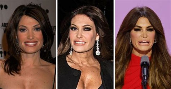 Kimberly Guilfoyle's Dramatic Facial Transformation: Unmasking The Details