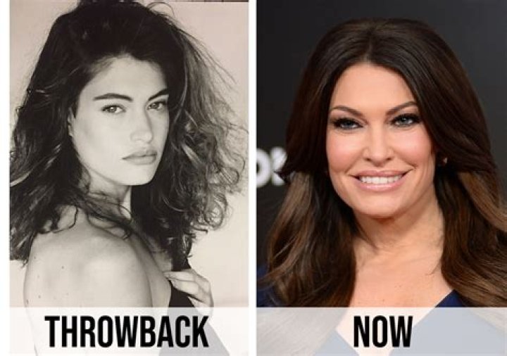 Kimberly Guilfoyle's Facelift: Before And After Transformation