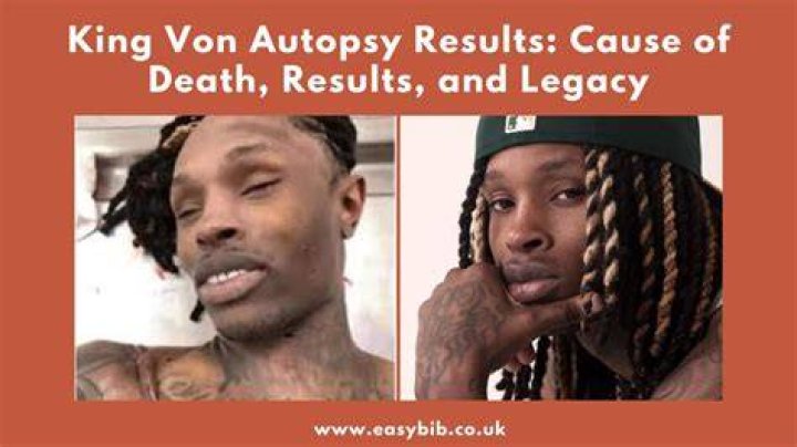 King Von Cause of Death Autopsy Reveals Startling Details