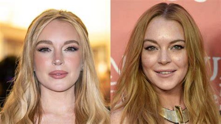 Lindsay Lohan Plastic Surgery Pictures