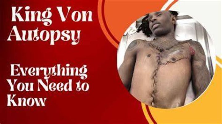 The Controversial Autopsy of King Von What We Know So Far