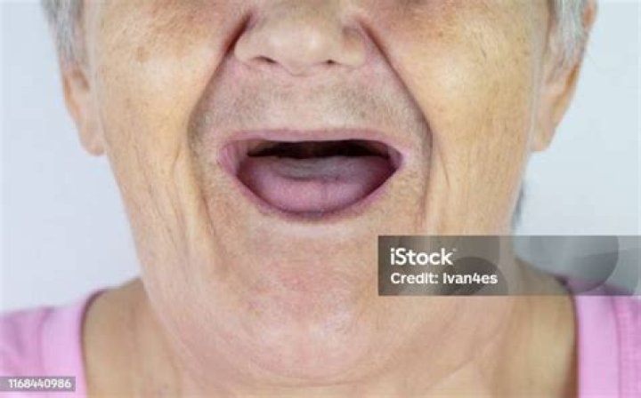 Toothless mouth. An elderly woman with no teeth. Old Granny with her