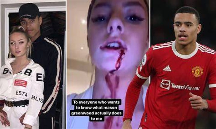 Unraveling The Mysteries Of Harriet Robson's Injuries